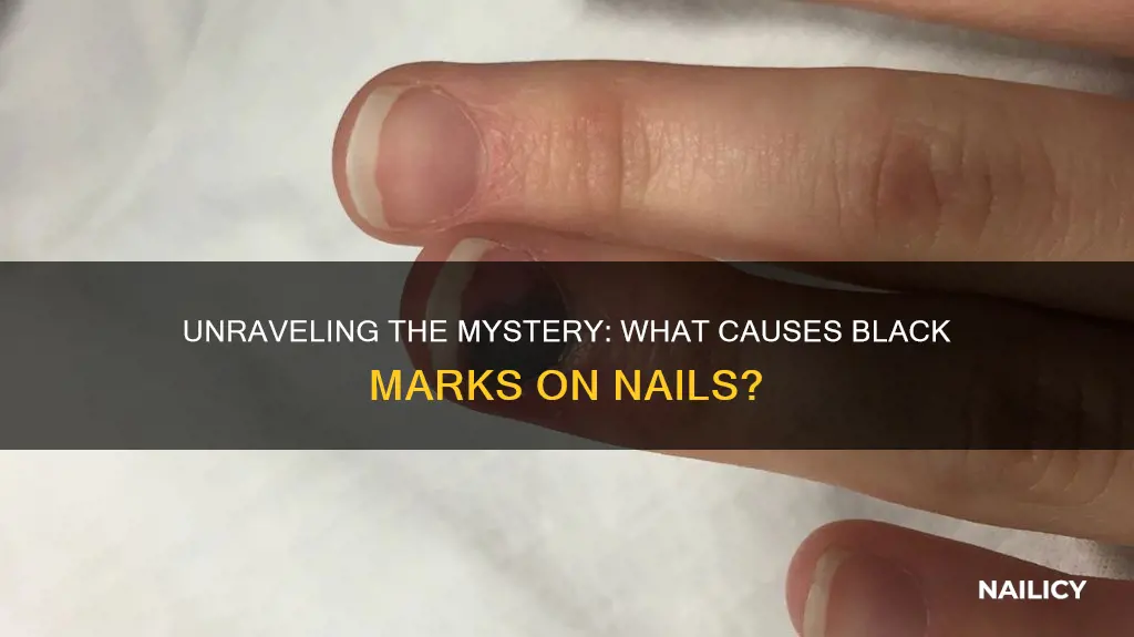 what does a black mark on your nail mean