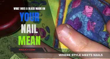 Black Marks on Nails: What Your Body Is Trying to Tell You