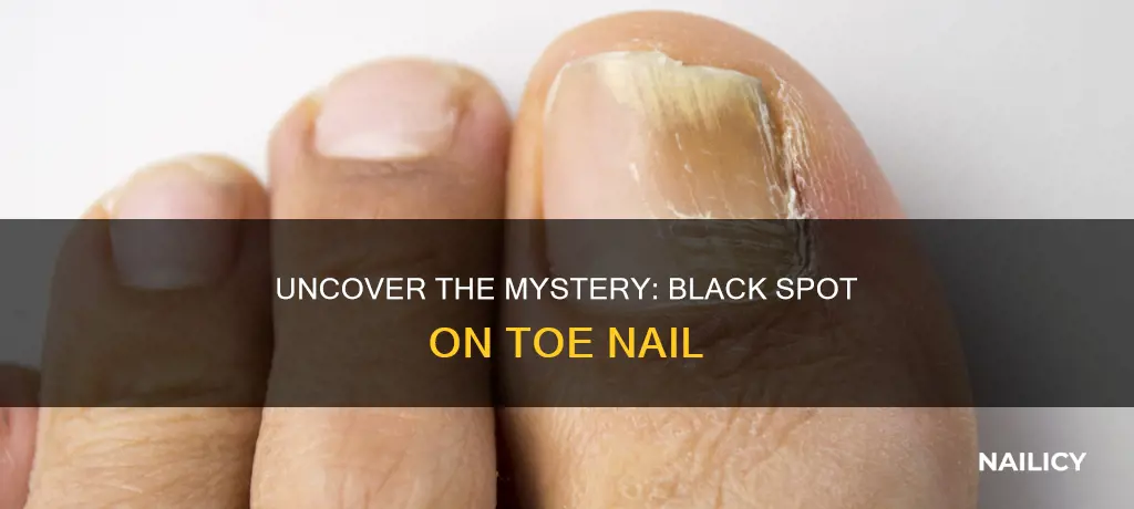 what does a black spot on your toe nail mean