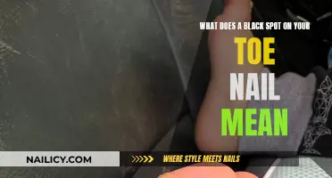 Black Spot on Toenail: What Does It Mean?
