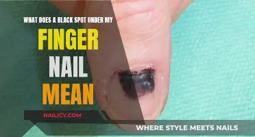 Black Spot Under Nail: Understanding the Possible Causes and When to Seek Help