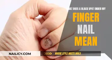 Black Spot Under Fingernail: What Does It Mean?