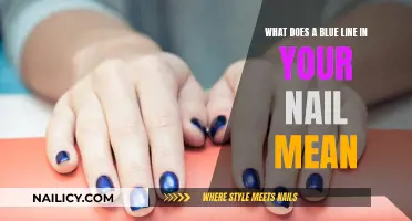 The Mystery of Blue Lines in Your Nails