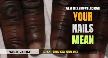 Brown Line on Nails: What Does It Mean?