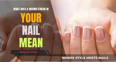 Brown Streaks on Nails: What Your Body Is Trying to Tell You