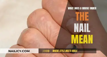 Unraveling the Mystery: What Causes Bruises Under Your Nails?