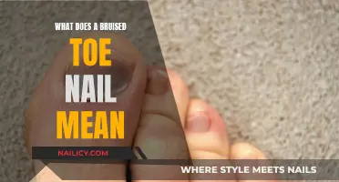 Understanding the Meaning of a Bruised Toe Nail