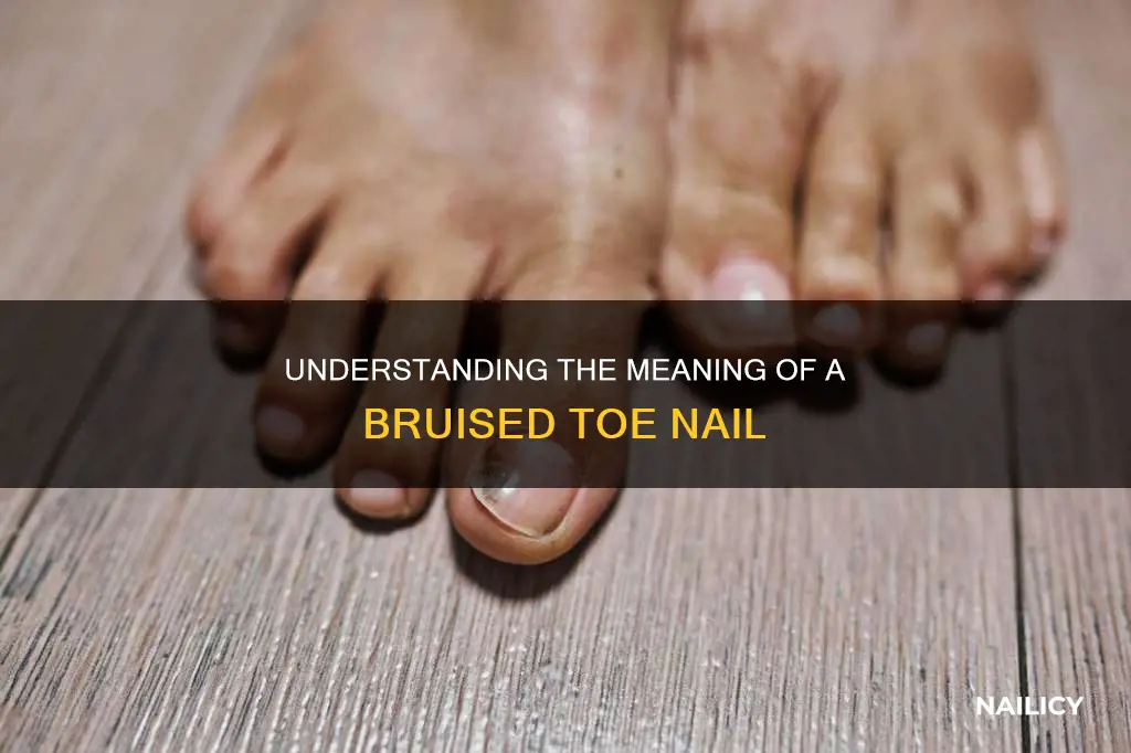 what does a bruised toe nail mean