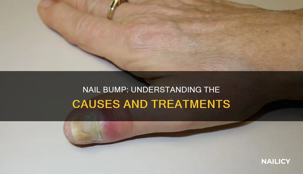 what does a bump in the nail mean