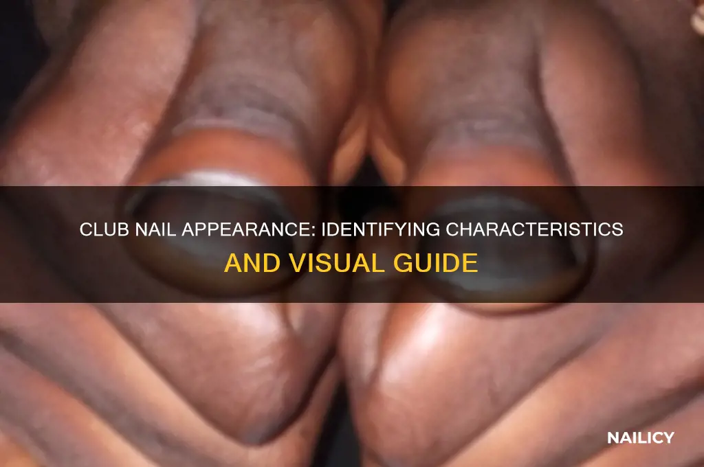 what does a club nail look like