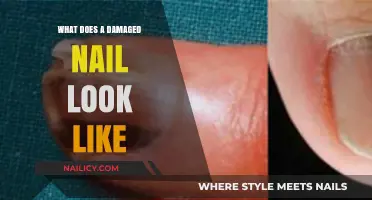 Identifying Damaged Nails: Signs, Symptoms, and What to Look For