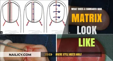Identifying a Damaged Nail Matrix: Symptoms, Appearance, and Causes Explained