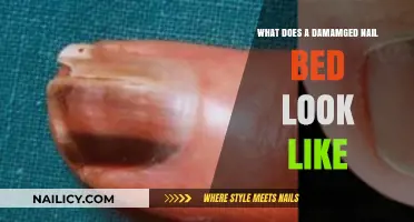 Identifying Damaged Nail Beds: Symptoms, Causes, and Visual Signs Explained