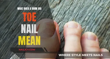 Dark Big Toe Nail: Uncover the Hidden Meaning