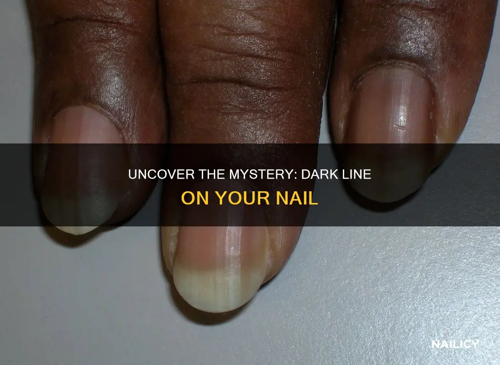 what does a dark line on your nail mean