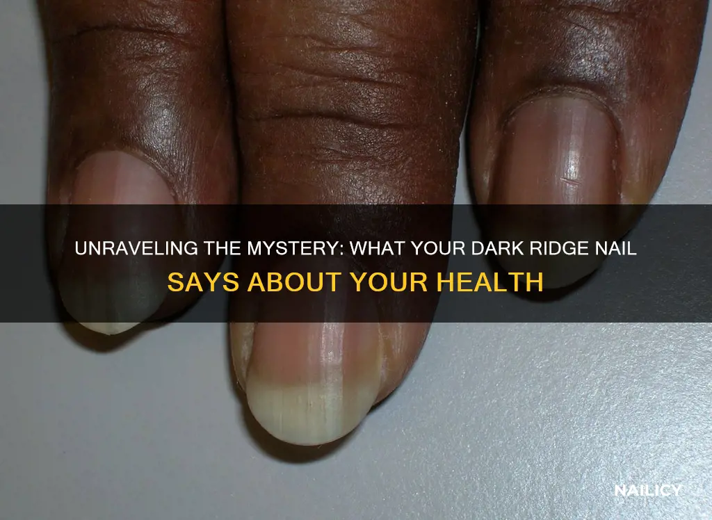 what does a dark ridge in your nail mean