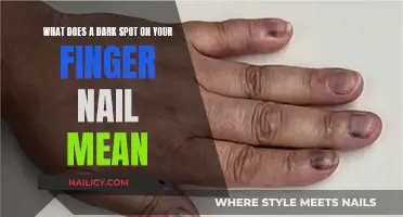 The Dark Spot on Your Fingernail: What Does It Mean?