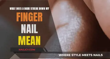 Dark Finger Nail Streaks: What Do They Mean?