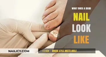 Identifying a Dead Nail: Appearance, Causes, and Treatment Options