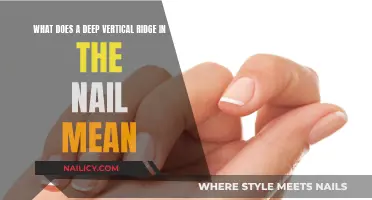 Vertical Ridges on Nails: What Do They Mean?