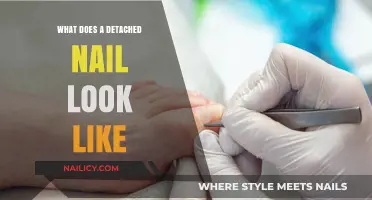 Detached Nail Appearance: Signs, Symptoms, and What to Expect