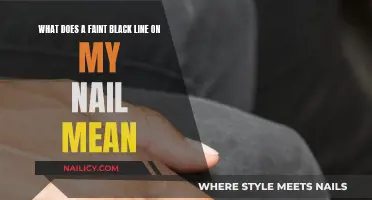 Black Line on Nails: What Does It Mean?