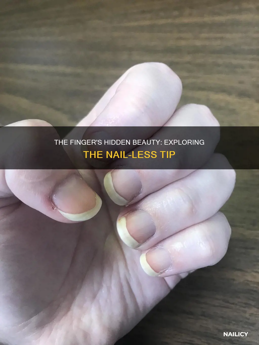 what does a finger look like without a nail