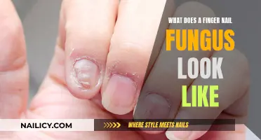 Identifying the Signs: What Finger Nail Fungus Looks Like