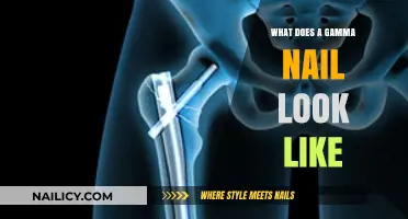 Understanding Gamma Nail Appearance: A Visual Guide to Its Design