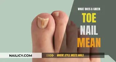 Green Toenails: What Does This Odd Color Indicate?