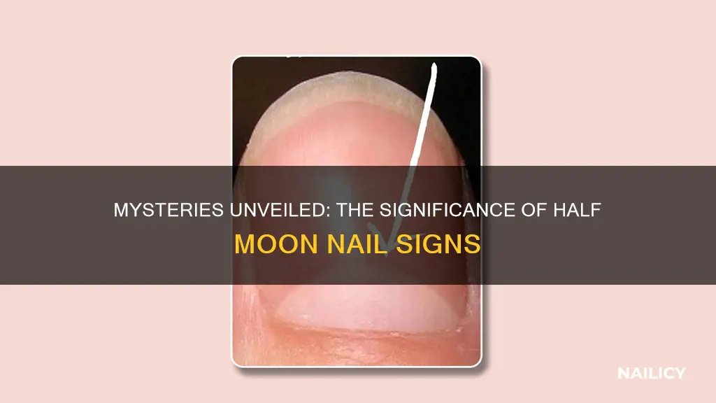 what does a half moon on your finger nail mean