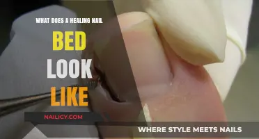 Healing Nail Bed Stages: Appearance, Recovery, and Healthy Growth Signs
