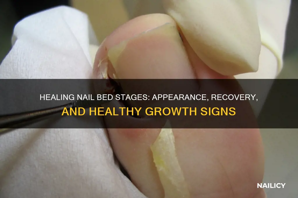 what does a healing nail bed look like