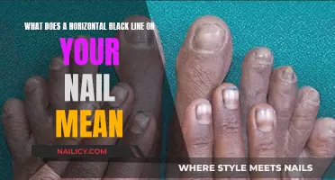 Unraveling the Mystery: Black Line on Nail