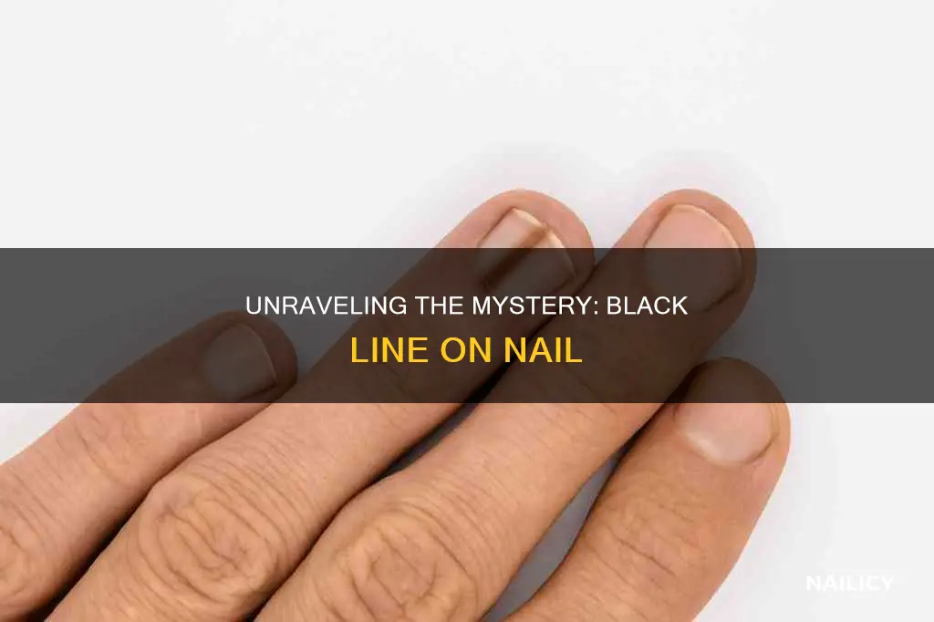 what does a horizontal black line on your nail mean