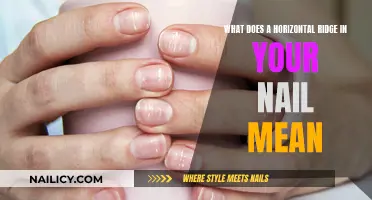 Unraveling the Mystery: Horizontal Ridges in Your Nails