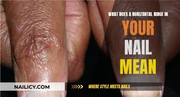 Horizontal Ridges on Nails: What Do They Indicate?
