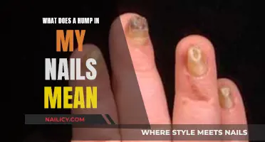 Hump in Nails: What Does It Mean?