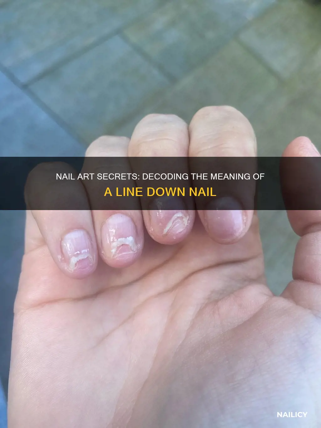 what does a line down nail mean