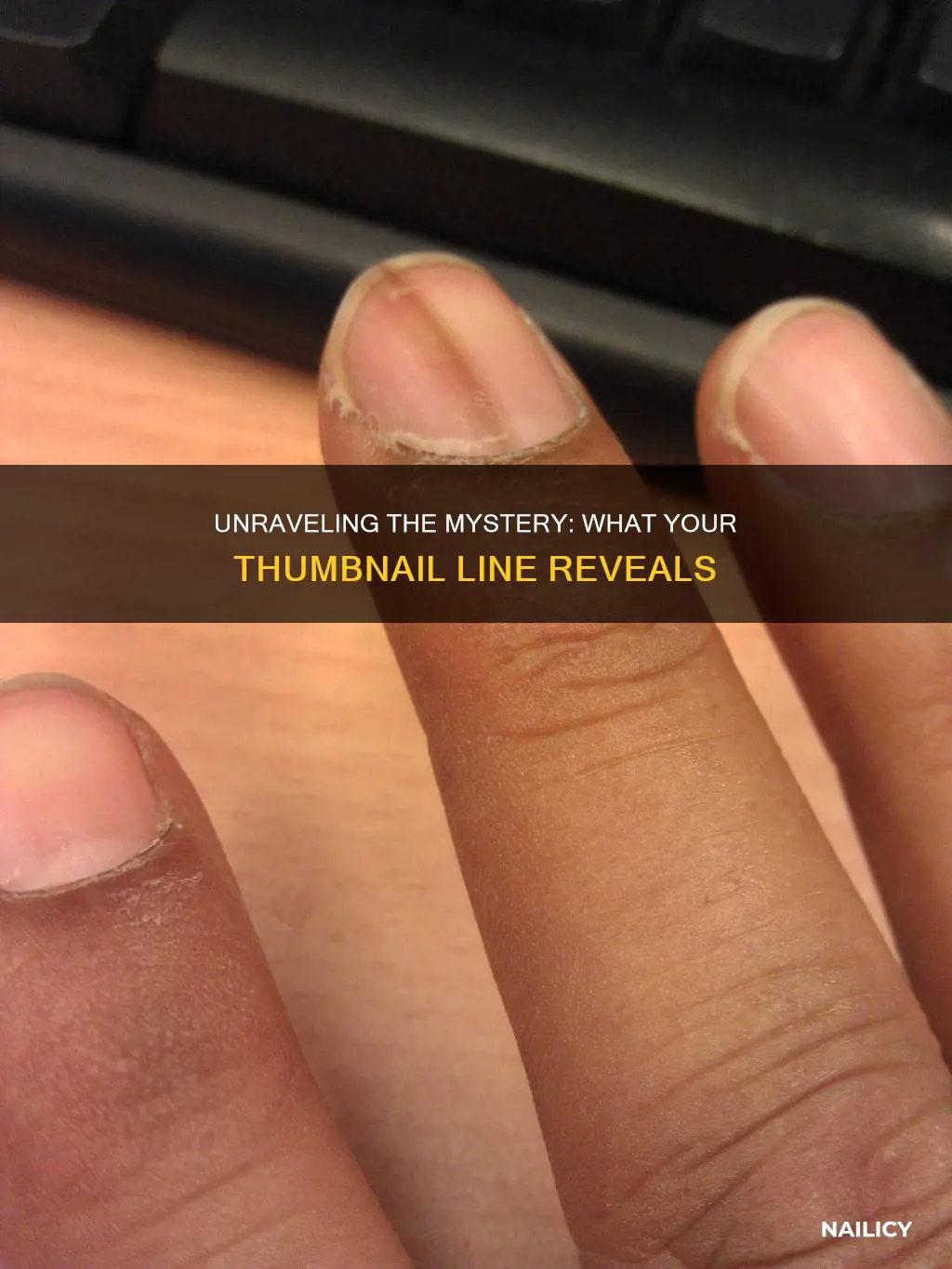 what does a line down your thumb nail mean