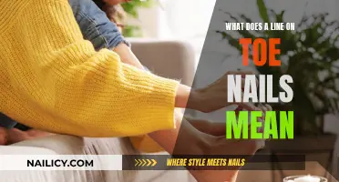 Toe Nail Lines: What Do They Mean?