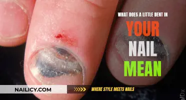 Unraveling the Mystery: What Your Nail Dent Reveals