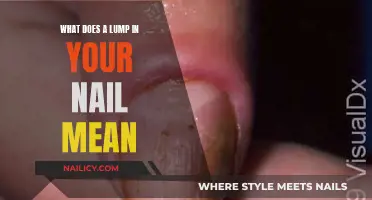 Unraveling the Mystery: What Causes a Lump in Your Nail?