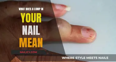 Lumps Beneath Nails: What Do They Mean?