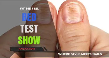 Nail Bed Test: Unveiling Vital Health Insights Through Simple Examination