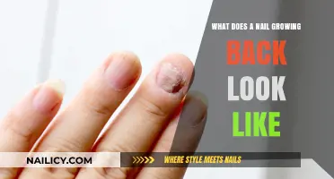 Nail Growing Back: What's the Process and Appearance?