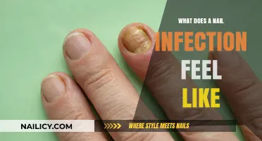 Understanding Nail Infections: Symptoms, Discomfort, and Early Warning Signs