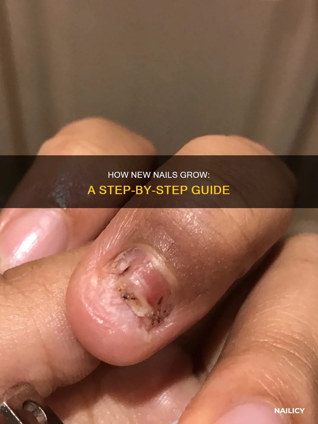 what does a new nail growing in look like