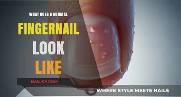 Understanding Healthy Fingernails: What a Normal Nail Should Look Like