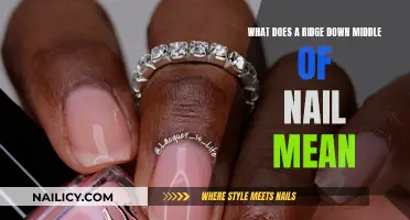 Ridge Nails: What Do They Mean?